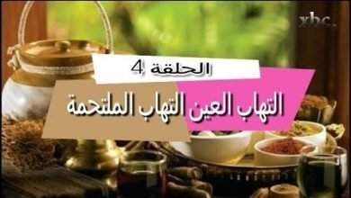 الحلقة (4)  علاج التهاب العين