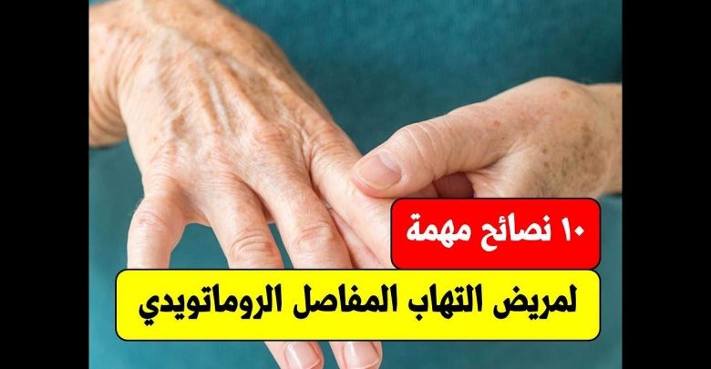 10 نصائح مهمة لمريض التهاب المفاصل الروماتويدي | نصائح غذائية لمرضى التهاب المفاصل الرماتويدى