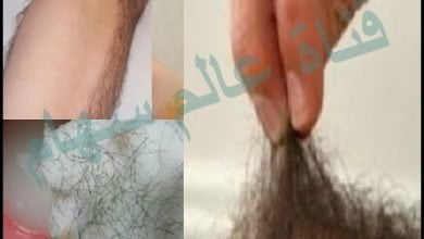 خلطة حصرية على اليوتوب لازالة شعر المناطق الحساسة ل 5 سنوات بمكونات بسيطة مضمونة %100