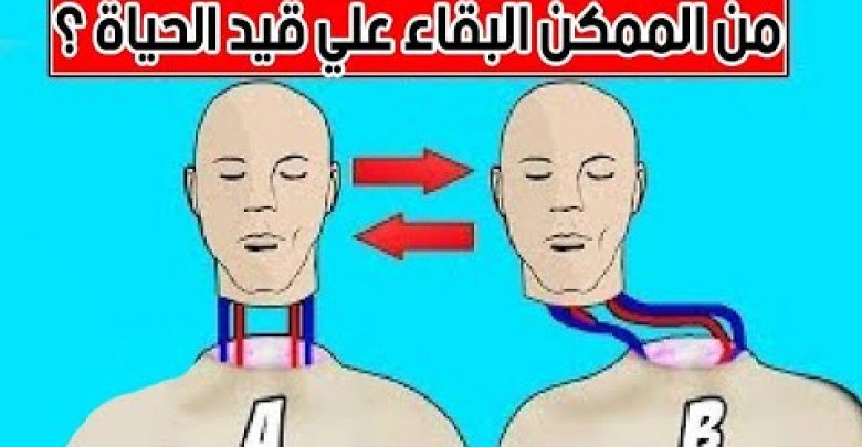 هل من الممكن البقاء علي ” قيد الحياة ” في هذة الحالات الثلاثة ..!