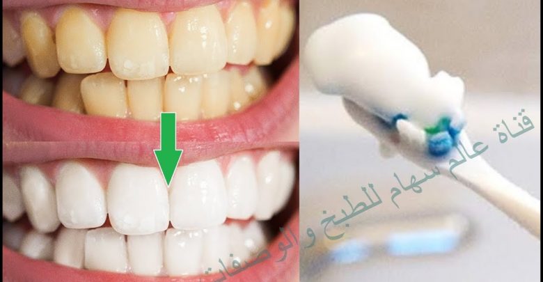 كيف ابيض اسناني ب طريقة سريعة وسهلة لتبيض الاسنان بمكون واحد فقط