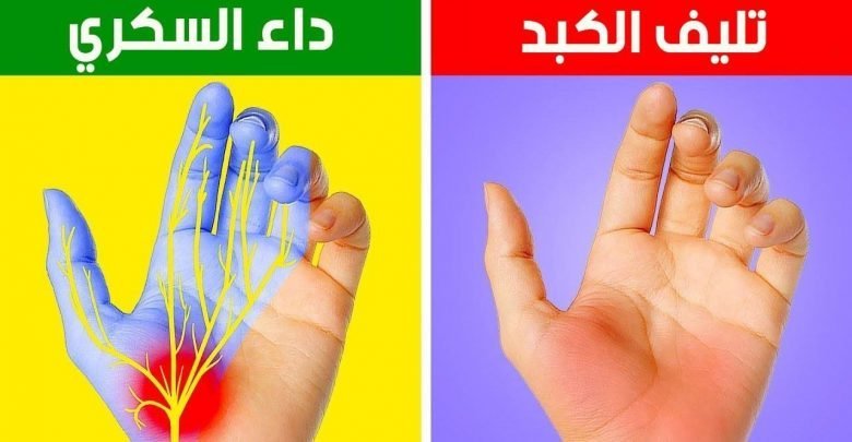 12 مشكلة صحية تنبهك يداك إليها