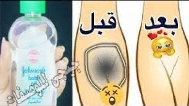 وضعت زيت الاطفال على المنطقه الحساسه.. تبيض ب 3 ايام فقط