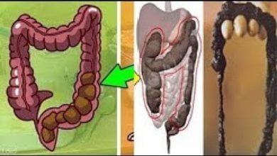 تنظيف القولون في 8 دقائق سيخرج من بطنك الفضلات و الغازات و سيزول الانتفاخ