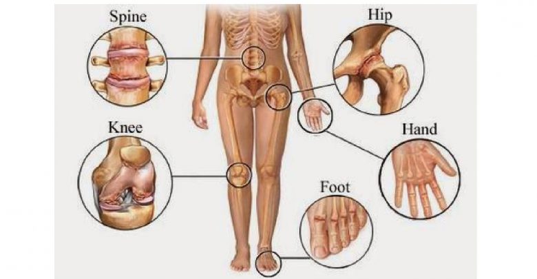 علاج آلام الروماتيزم / Guérir les douleurs rhumatismales / Cure rheumatic pains