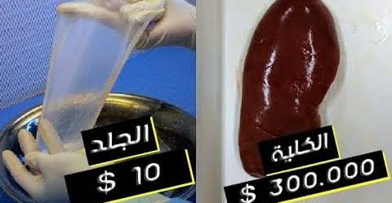 تعرف على سعر أعضائك البشرية في السوق السوداء