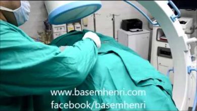 علاج الانزلاق الغضروفى و عرق النسا  بالليزر التداخلى endo laser مركز رعاية العمود الفقرى