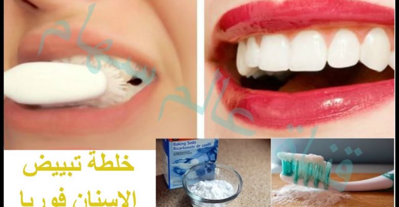 بيضي اسنانك في 5 دقائق دون طبيب خلطة افركي بها اسنانك لتصبح كحبات اللؤلؤمن الاستخدام الاول فقط