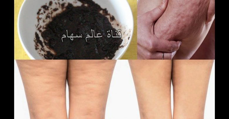 في 5 دقائق تخلصي من السيلوليت و الخطوط البيضاء نهائيا احصلي على جسم شاب و اصغر 10 سنوات مذهلة