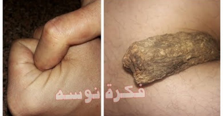 اسعدي زوجك كل ليلة بحبة واحدة من هذه ..ستبحثين عنها ..شاهدي ماذا يحدث؟