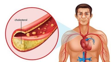 الوصفة الألمانية المذهلة للقضاء على الدهون في الدم و إنسداد الشرايين
