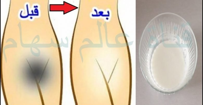 منطقتك الحساسة ستصبح ببياض الحليب مهما كان الاسمرار بها بخلطة قوية تجدد الجلد و تبيضه للابد