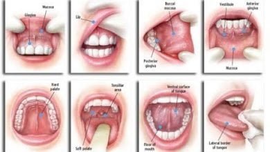 ٨ علامات لاكتشاف سرطان الفم مبكراً
