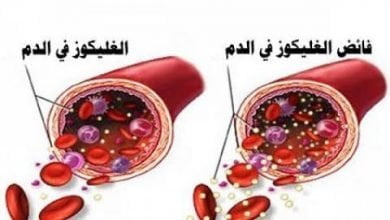 خفضوا مستوى السكر في دمكم فوراً مع هذه الأطعمة