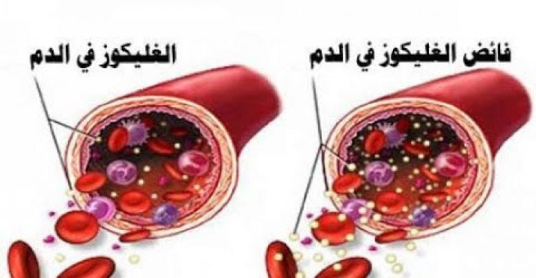 خفضوا مستوى السكر في دمكم فوراً مع هذه الأطعمة