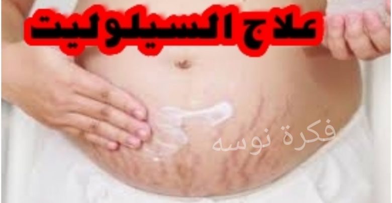 في 5 دقائق تخلصي من السيلوليت و الخطوط البيضاء نهائيا احصلي على جسم شاب و اصغر 10 سنوات مذهلة