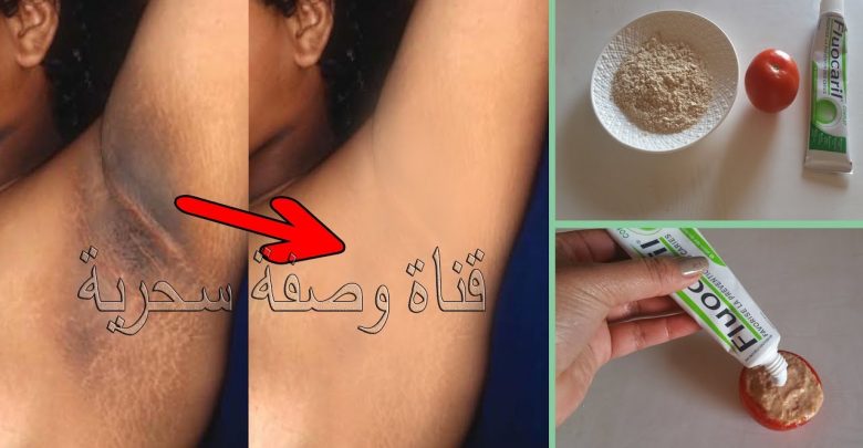 تخلصي من سواد الإبطين والمناطق الحساسة في 5دقائق فقط حتى إن كان السواد قديم و قاتم لا حرج بعد اليوم