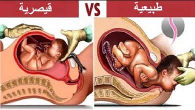 10 أشياء لم تكن تعرفها , عن الولادة الطبييعة و القيصرية .. !!