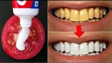 قل وداعا لطبيب الوصفة الربانية لتبييض الأسنان في أقل من 2 دقائق/اسنان كالثلج