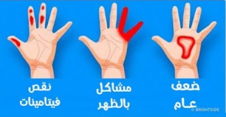 يلا خبر  | 7 علامات تظهر على الأيدي قد تدل على وجود مشاكل صحية خطيرة فلا تهملها