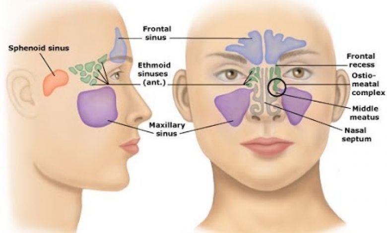 يلا خبر  | أعراض التهاب الجيوب لأنفية