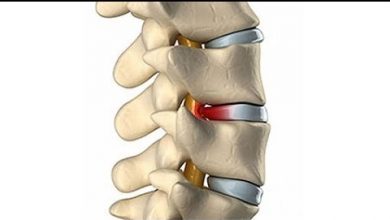 يلا خبر  | أعراض ديسك الظهر وطرق العلاج